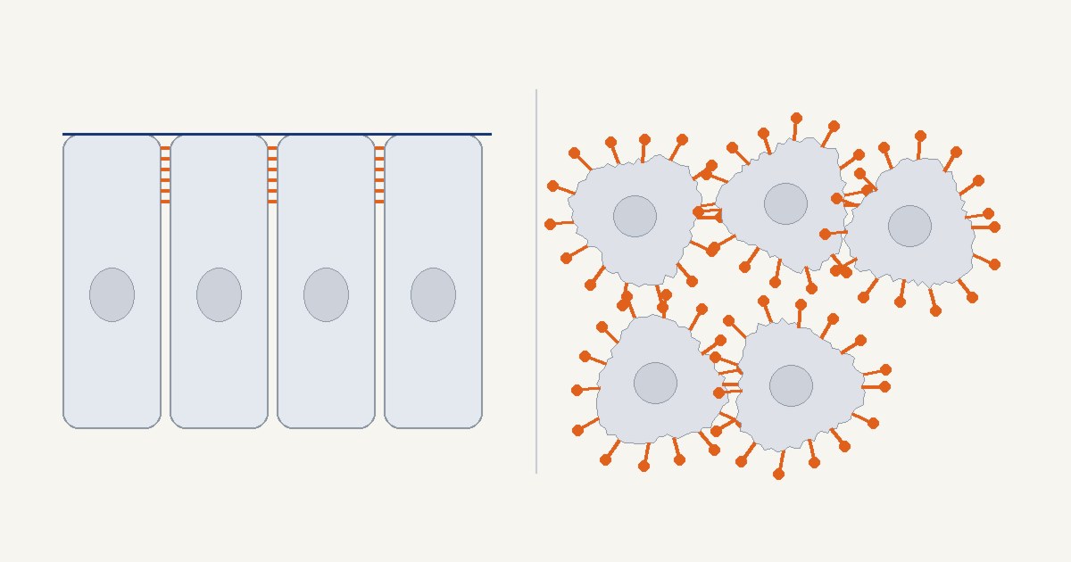 Claudin18.2 sealed between healthy gastric epithelial cells on the left and exposed on the surface of gastric tumour cells on the right — original illustration by Panacea Bio Chem